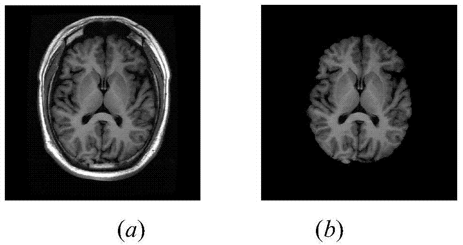 Fuzzy-connectedness-algorithm-based segmentation method of thalamus and substructures of thalamus