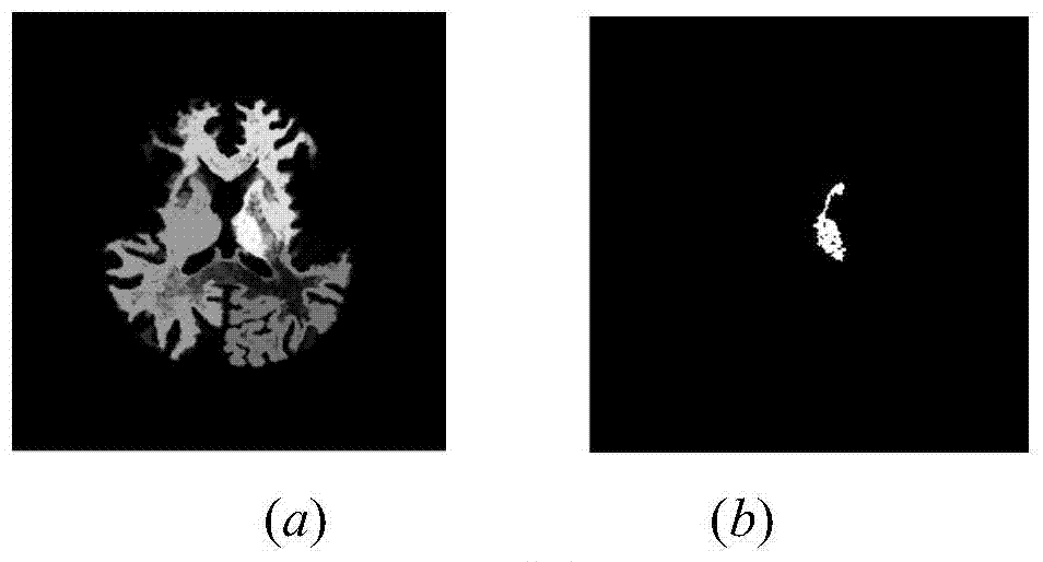 Fuzzy-connectedness-algorithm-based segmentation method of thalamus and substructures of thalamus