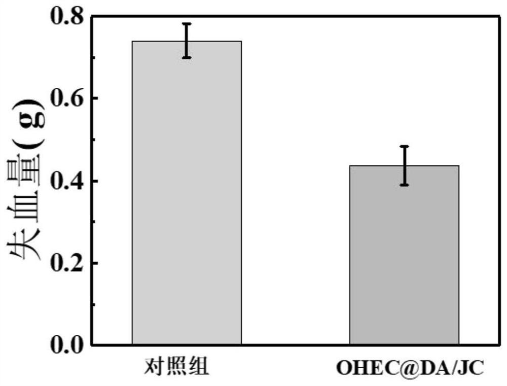 Preparation method of degradable antibacterial hemostatic hydrogel for promoting diabetes wound repair