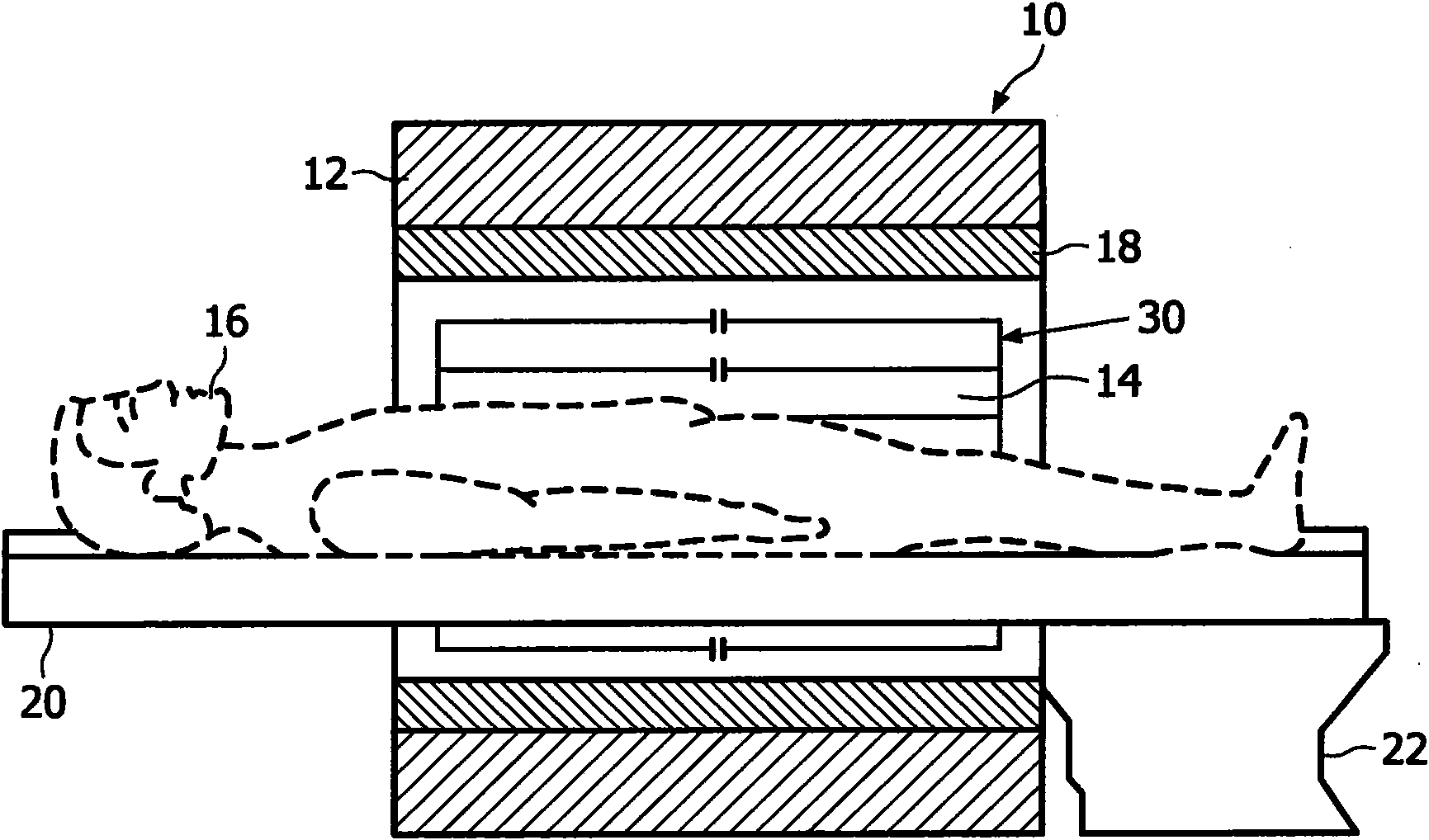 Dual tuned volume coils adapted to provide an end ring mode