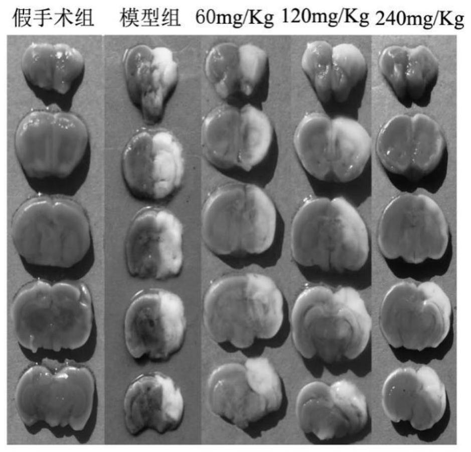 Use of Verbasidin in the preparation of medicaments for the treatment of neonatal hypoxic-ischemic encephalopathy