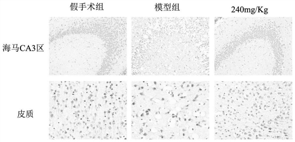 Use of Verbasidin in the preparation of medicaments for the treatment of neonatal hypoxic-ischemic encephalopathy