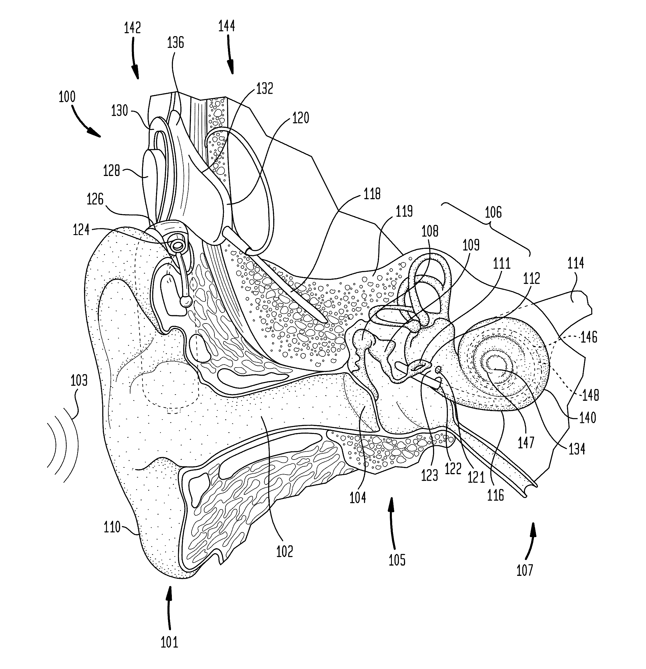 Contoured electrode contact surfaces