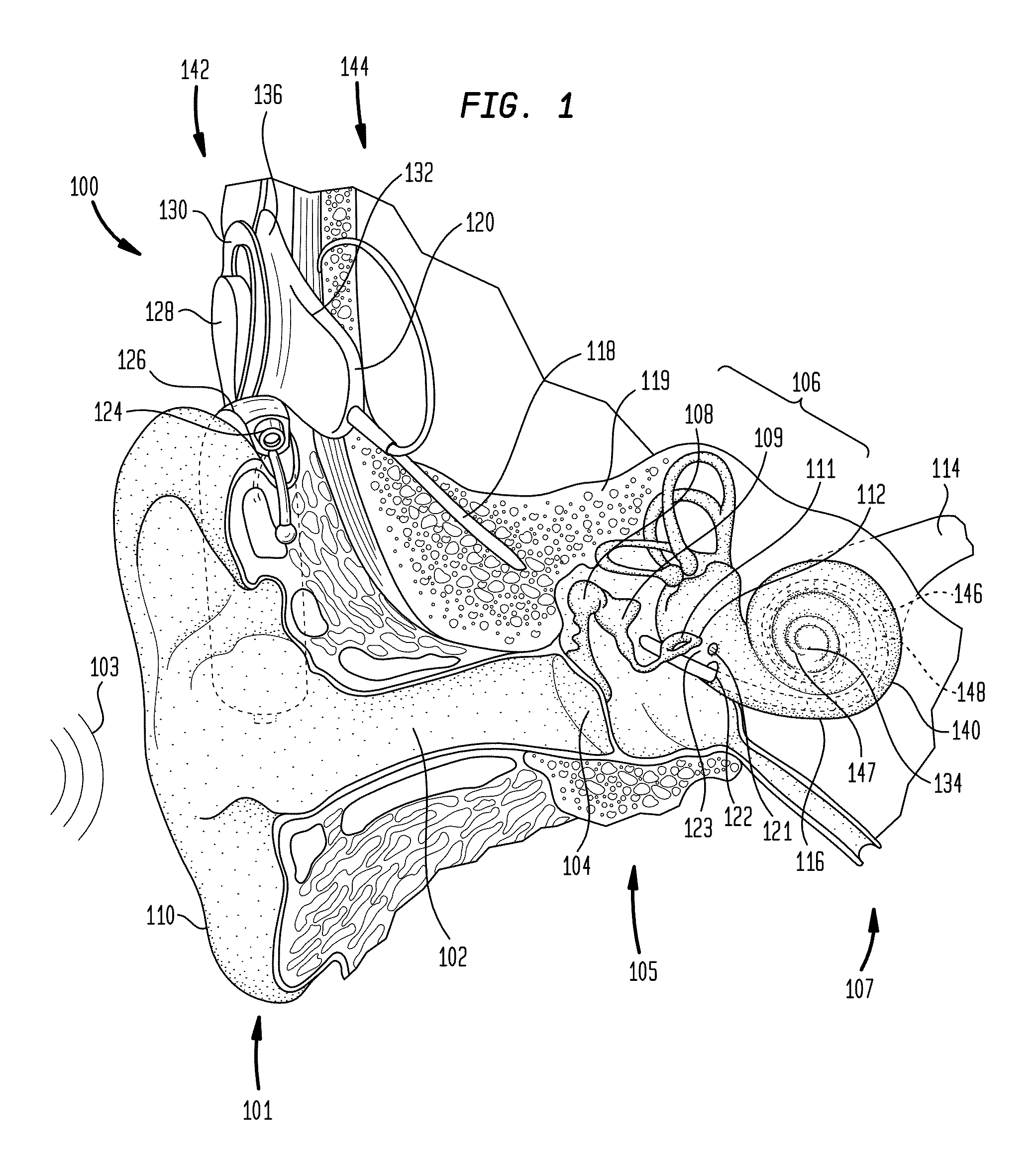 Contoured electrode contact surfaces