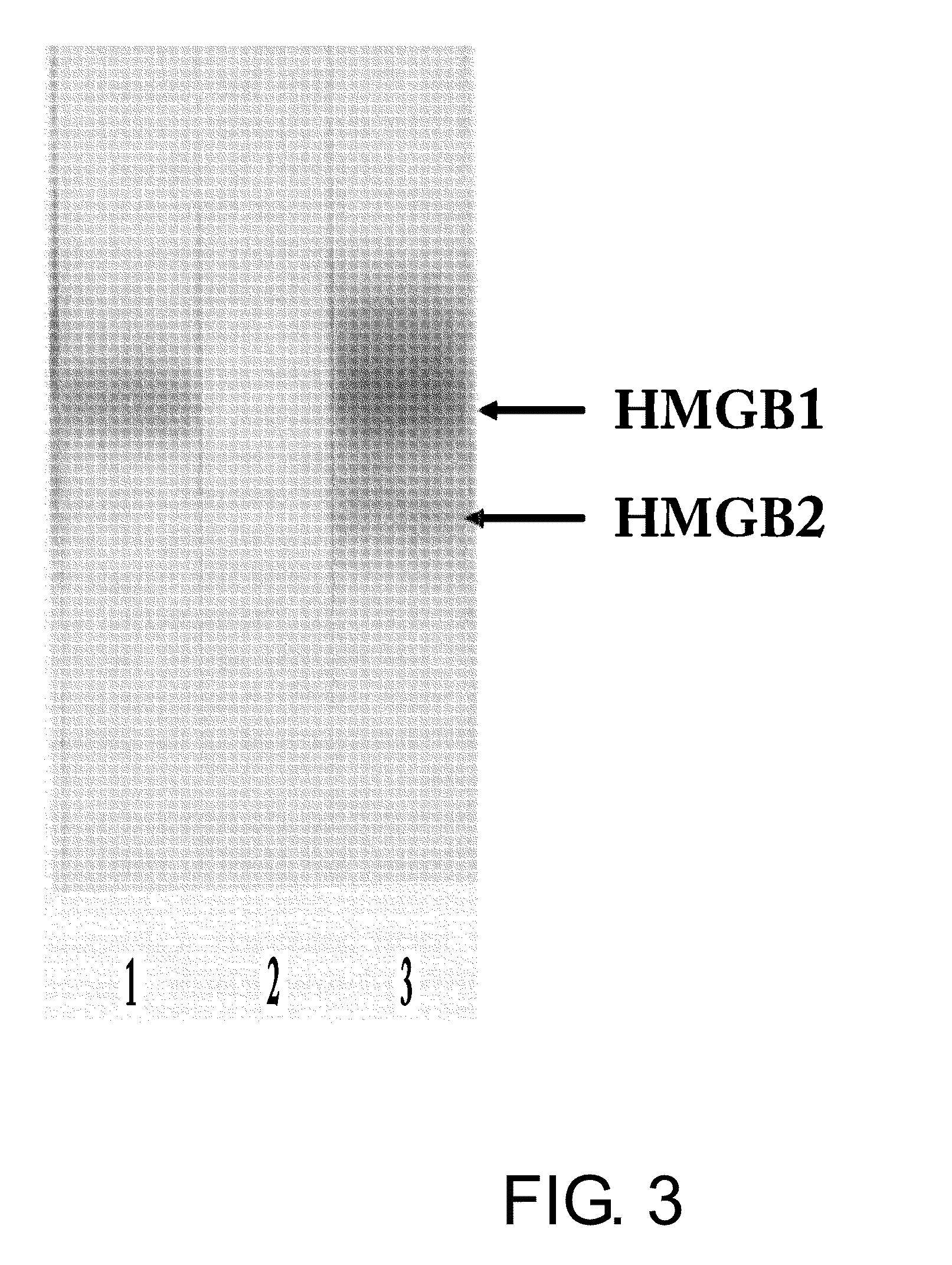 Agent for Suppressing Rejection in Organ Transplantation Comprising Anti-HMGB-1 Antibody