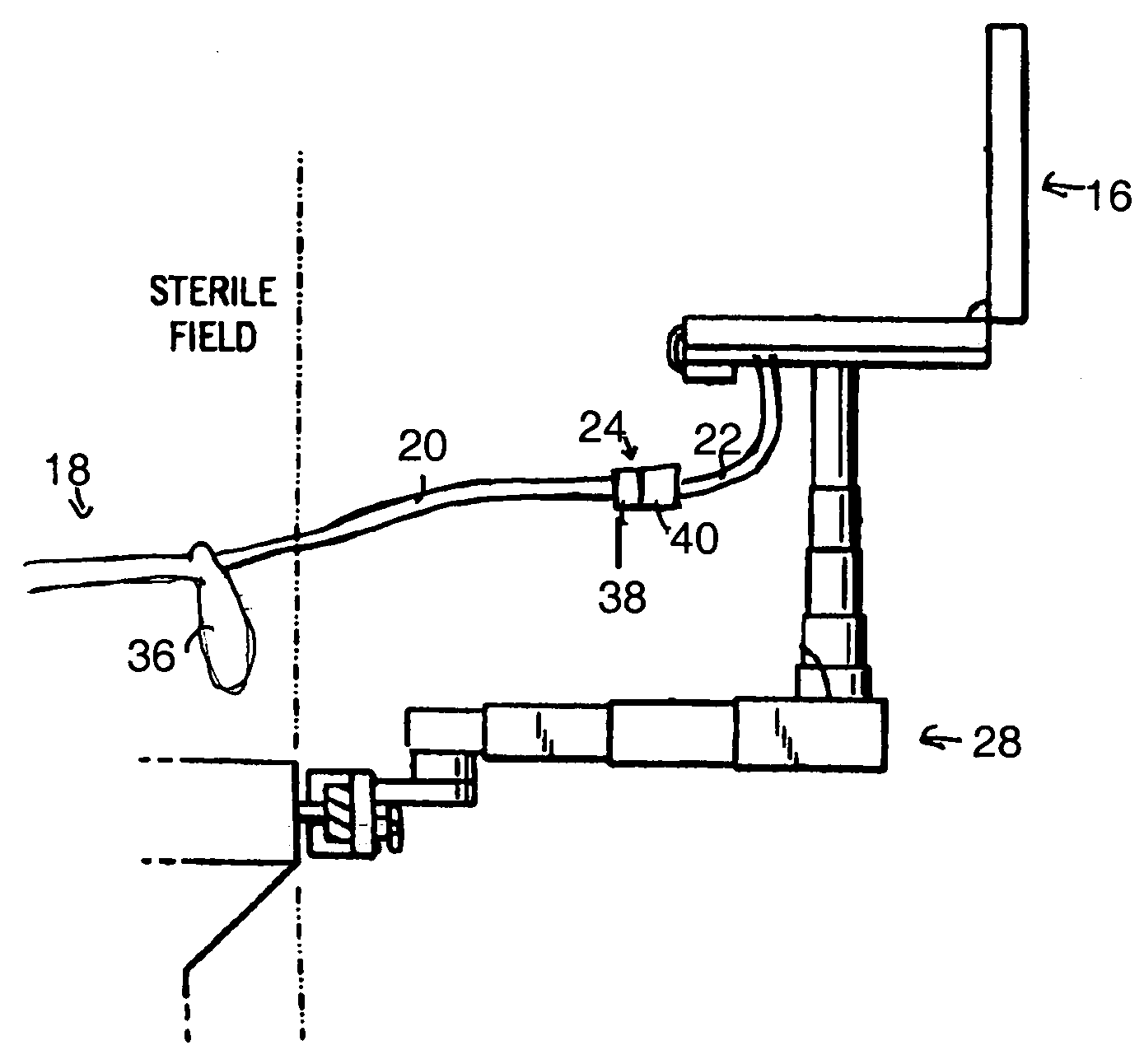 Catheter connector