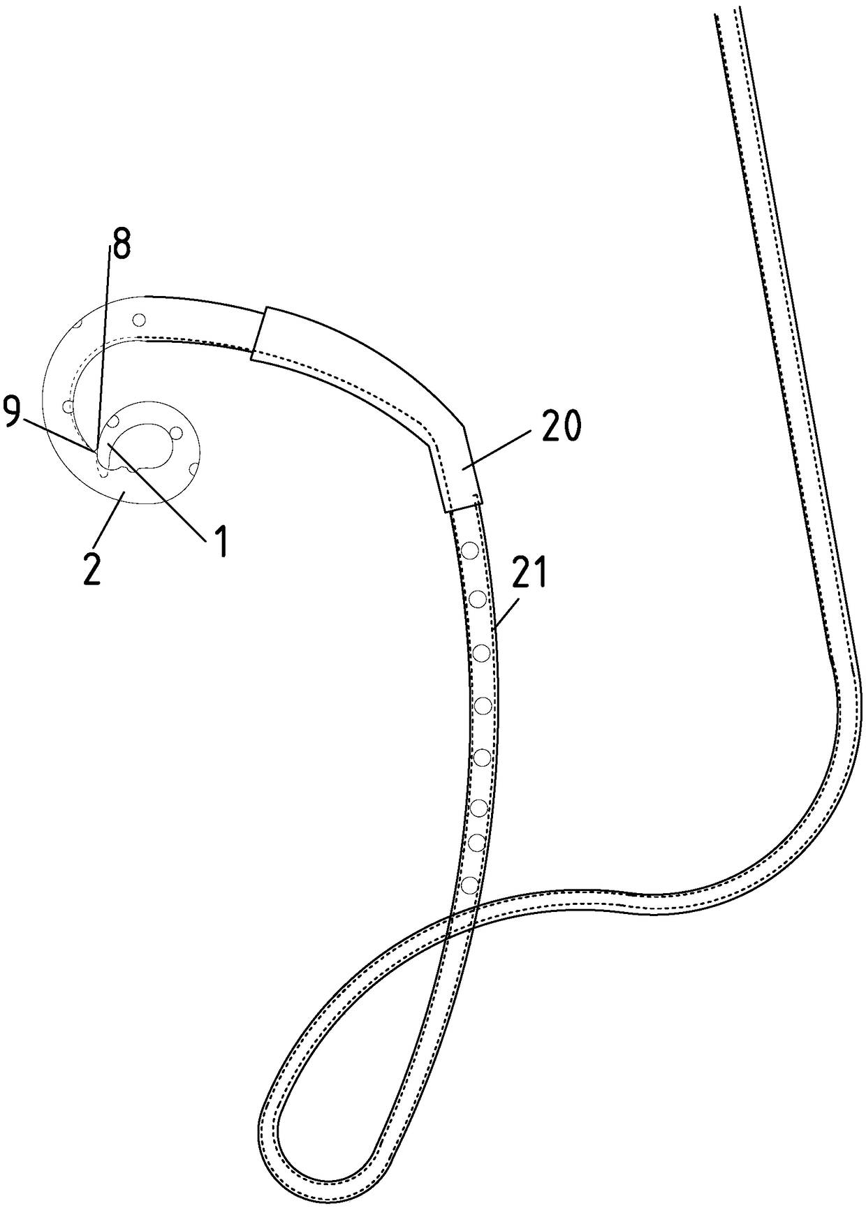 Nasal gallbladder bile drainage catheter with expansile saccule