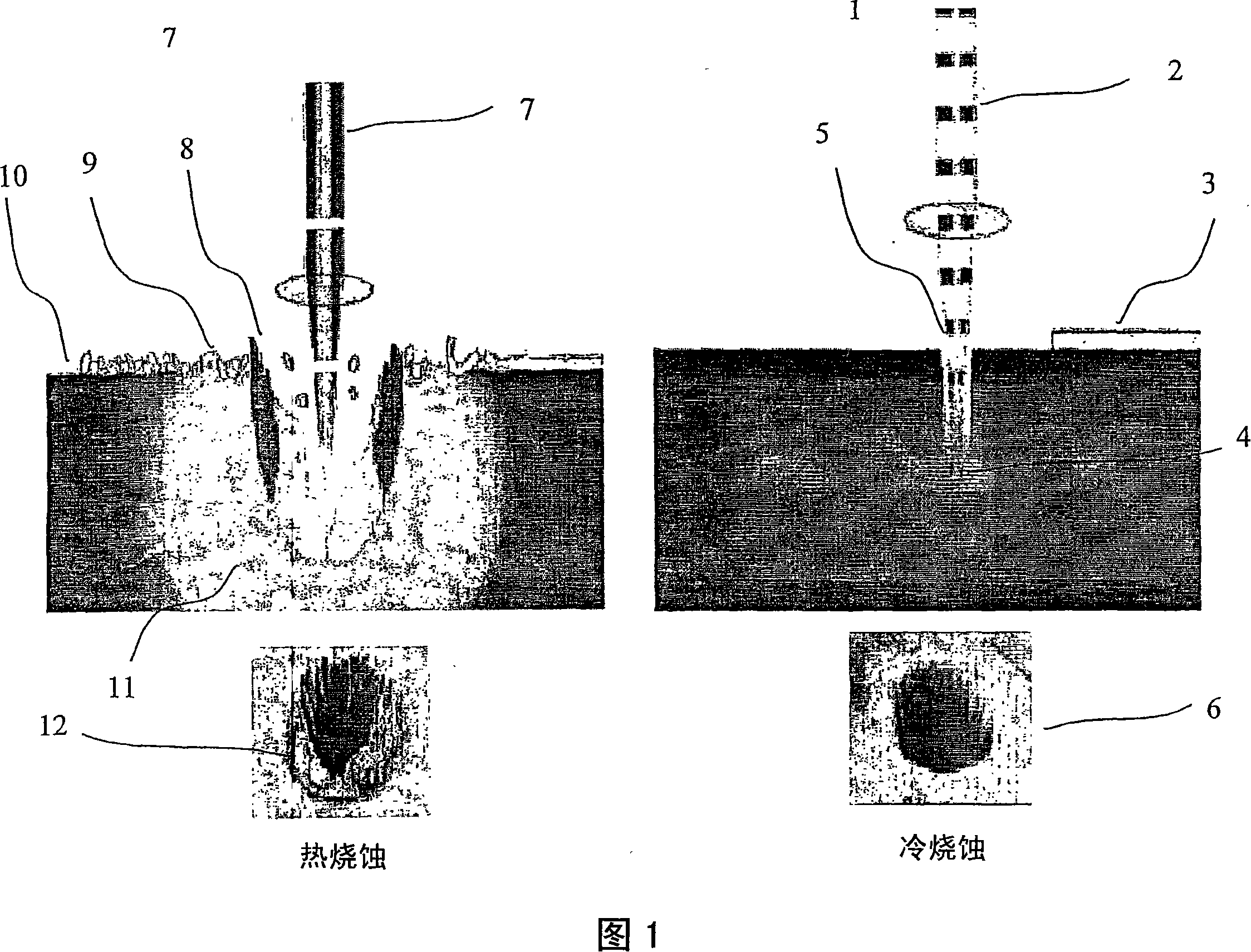 Pulse laser sediment method