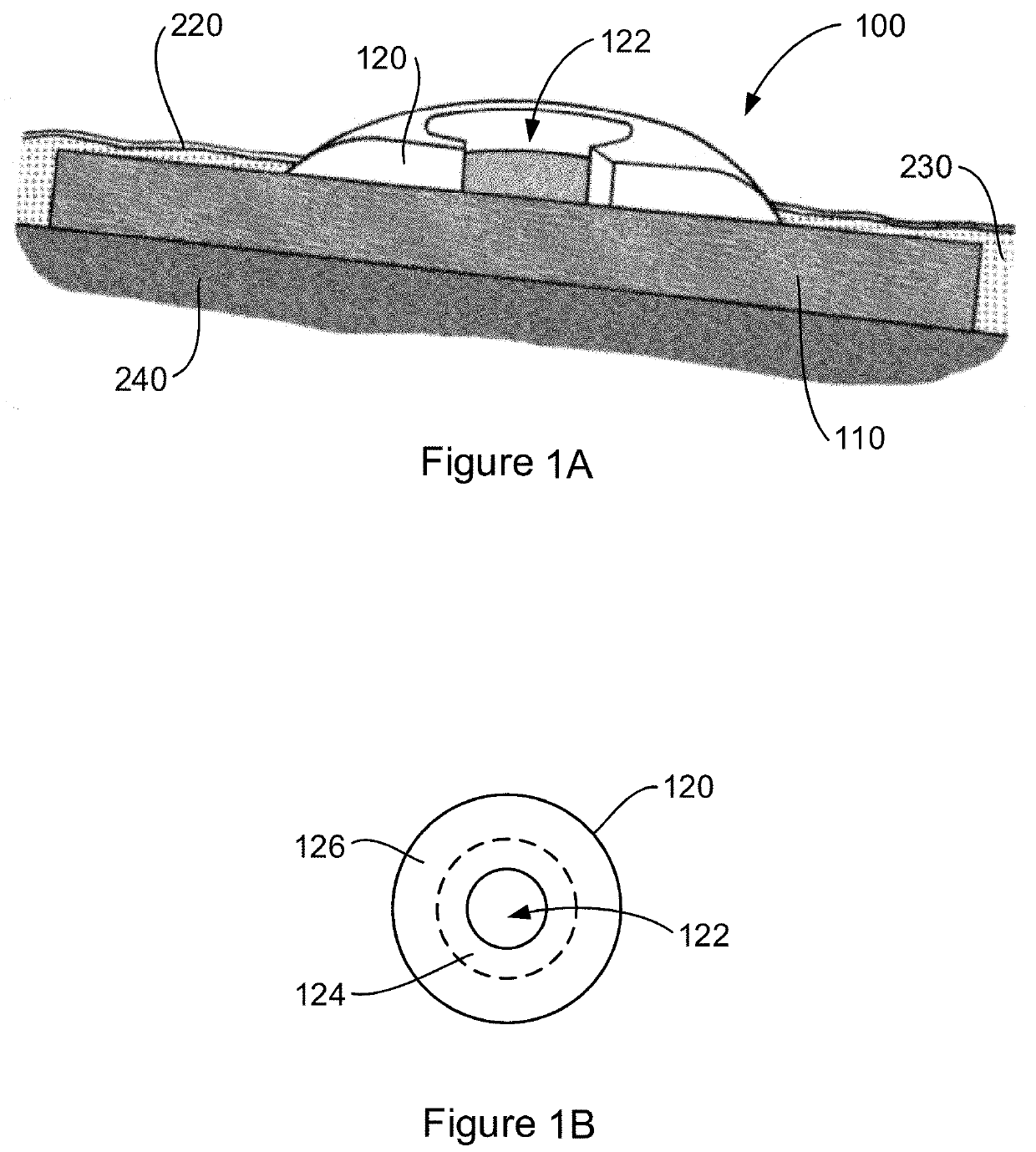 Implantable interface device