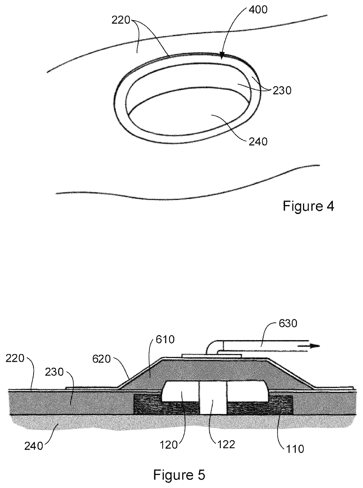 Implantable interface device