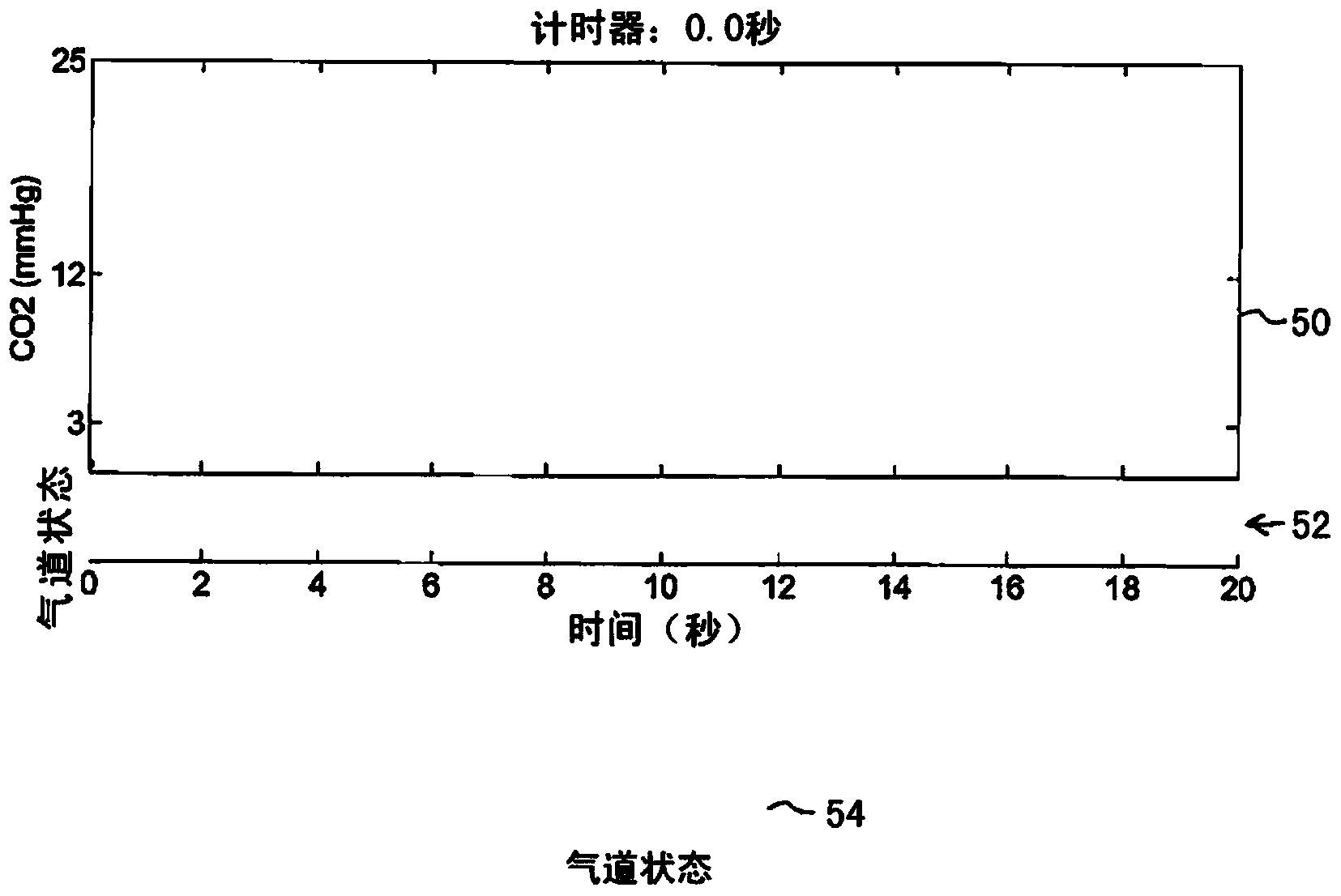 Real-time airway check status indicator