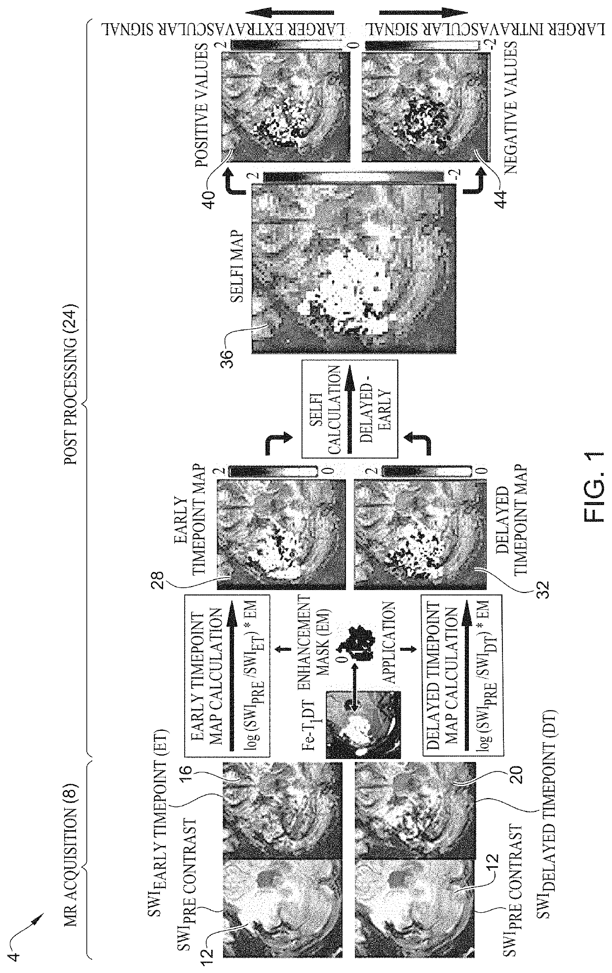 Distinguishing between extravascular and intravascular contrast pools