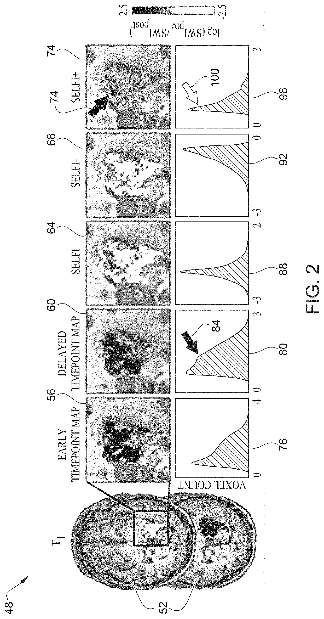 Distinguishing between extravascular and intravascular contrast pools