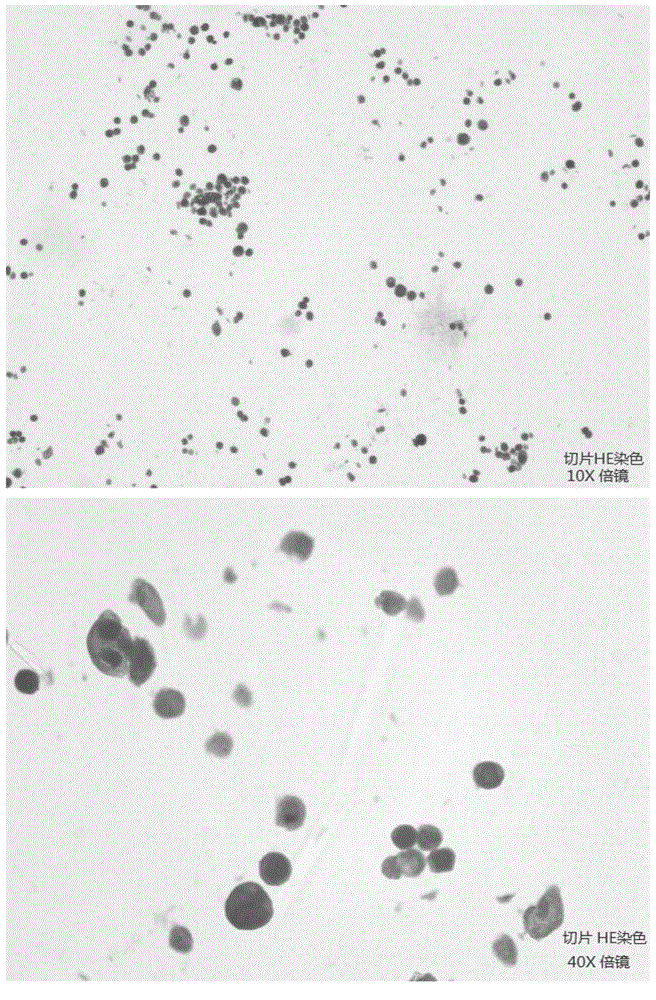 Quality control sample for detecting breast cancer and preparation method of quality control sample