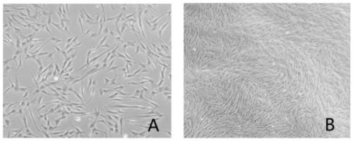 Method for preparing human umbilical cord mesenchymal stem cell exosomes