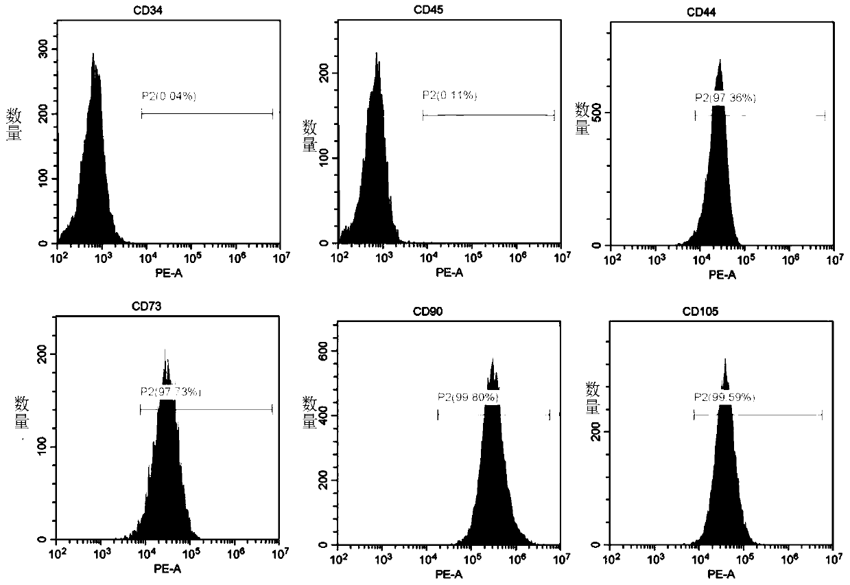 Method for preparing human umbilical cord mesenchymal stem cell exosomes