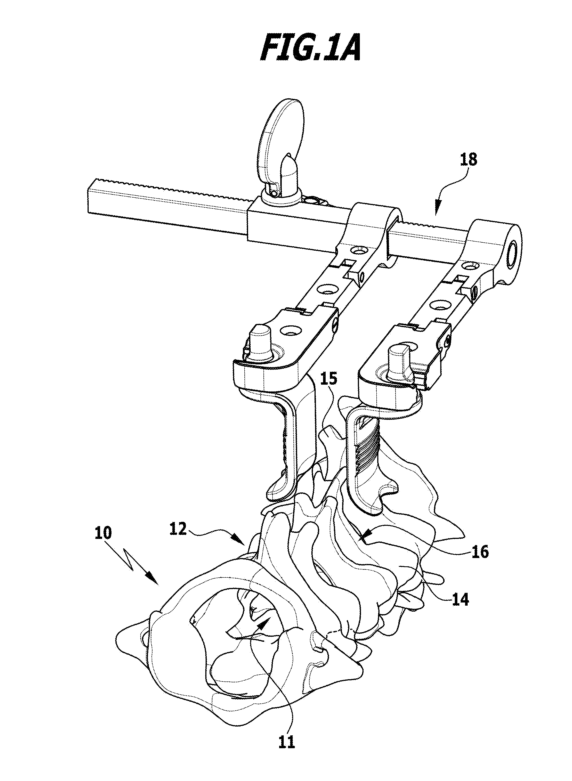 Surgical procedure for expanding a vertebral canal