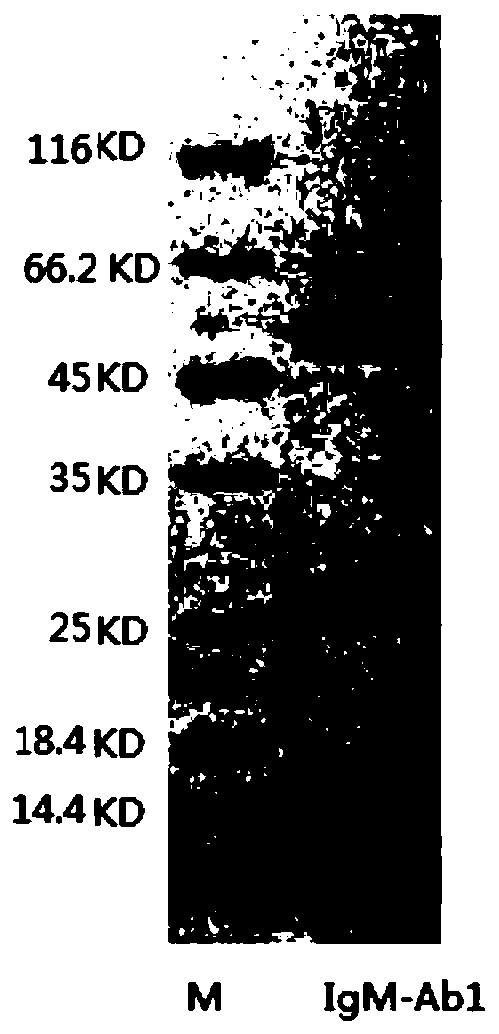 Anti-human igm monoclonal antibody, its hybridoma cell line and application