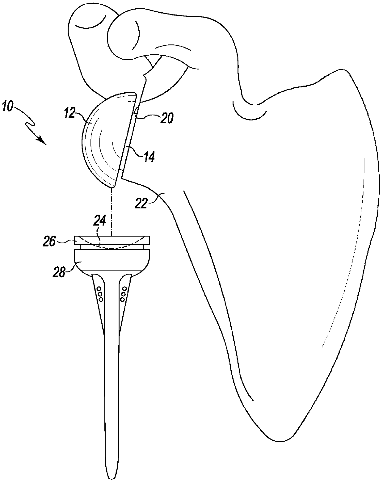 Reverse shoulder orthopaedic implant having elliptical glenosphere component