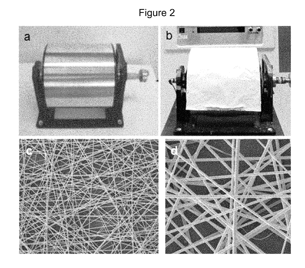 Wound dressing nanomesh impregnated with human umbilical cord Wharton's jelly stem cells