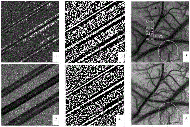 Laser speckle blood flow imaging enhancement method