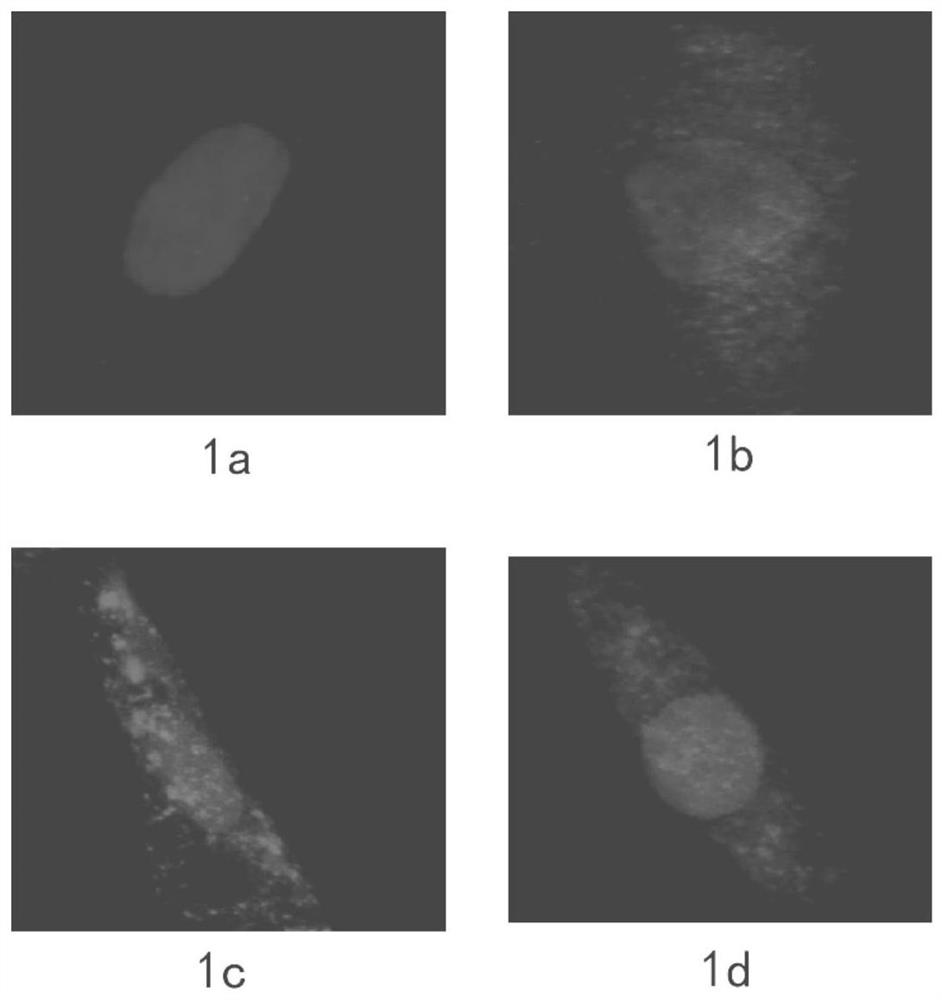 Anti-hair loss plant extract, preparation method thereof and application of plant extract