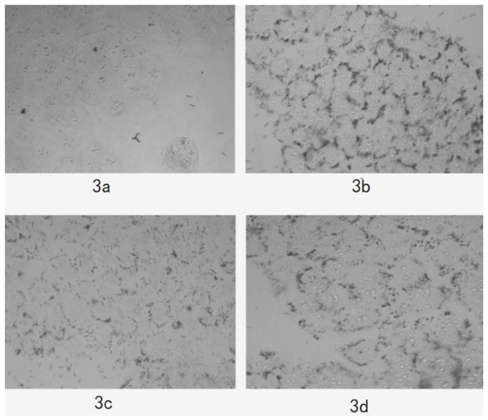 Anti-hair loss plant extract, preparation method thereof and application of plant extract