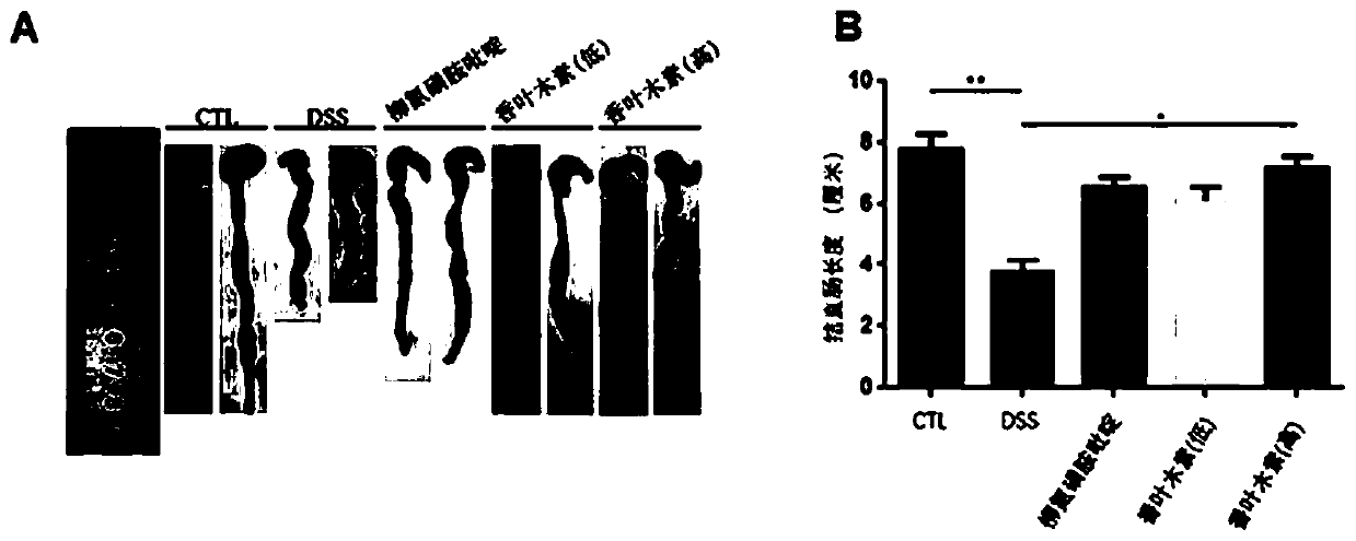 Application of diosmetin in preparation of medicament for treating inflammatory bowel disease