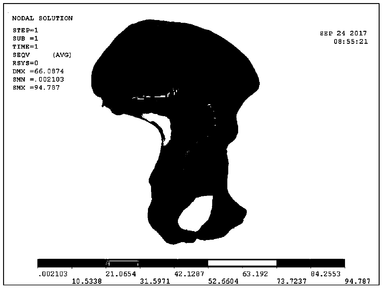 A method for preparing acetabular supplementary material