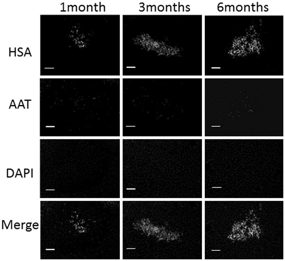 Preparation method and application of human induced hepatic-specified differentiation stem cells