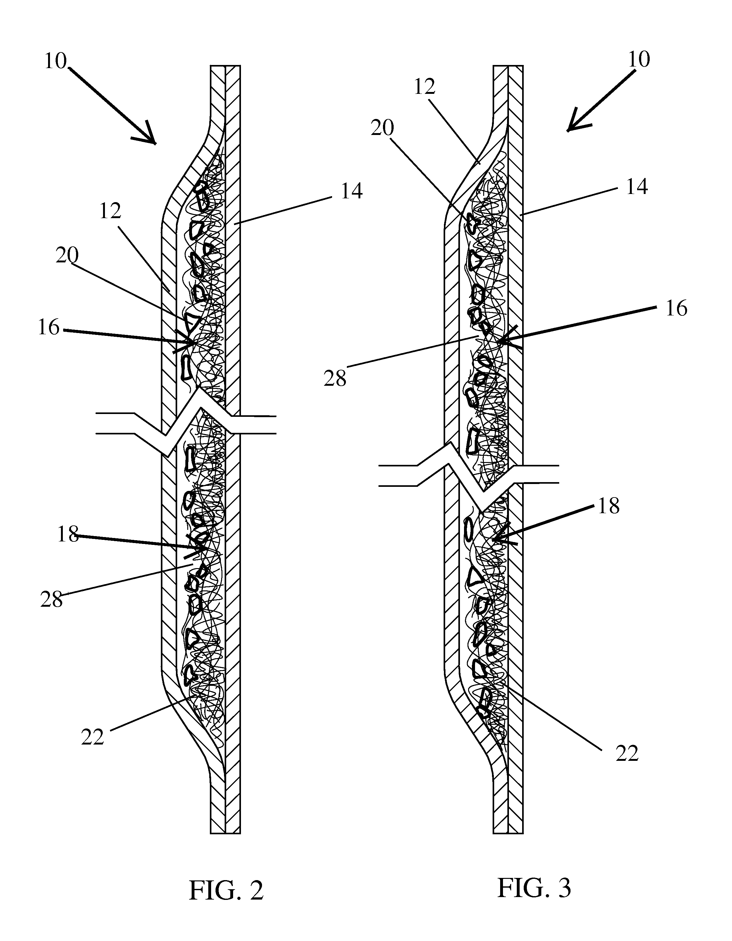 Heterogenous mass containing foam