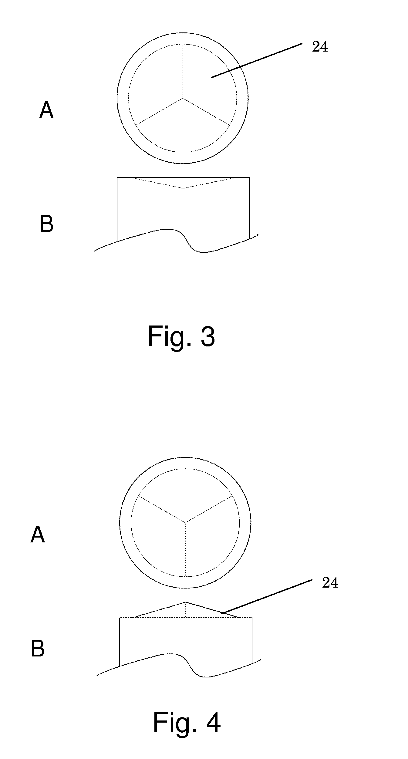 Laser hair and scalp treatment device