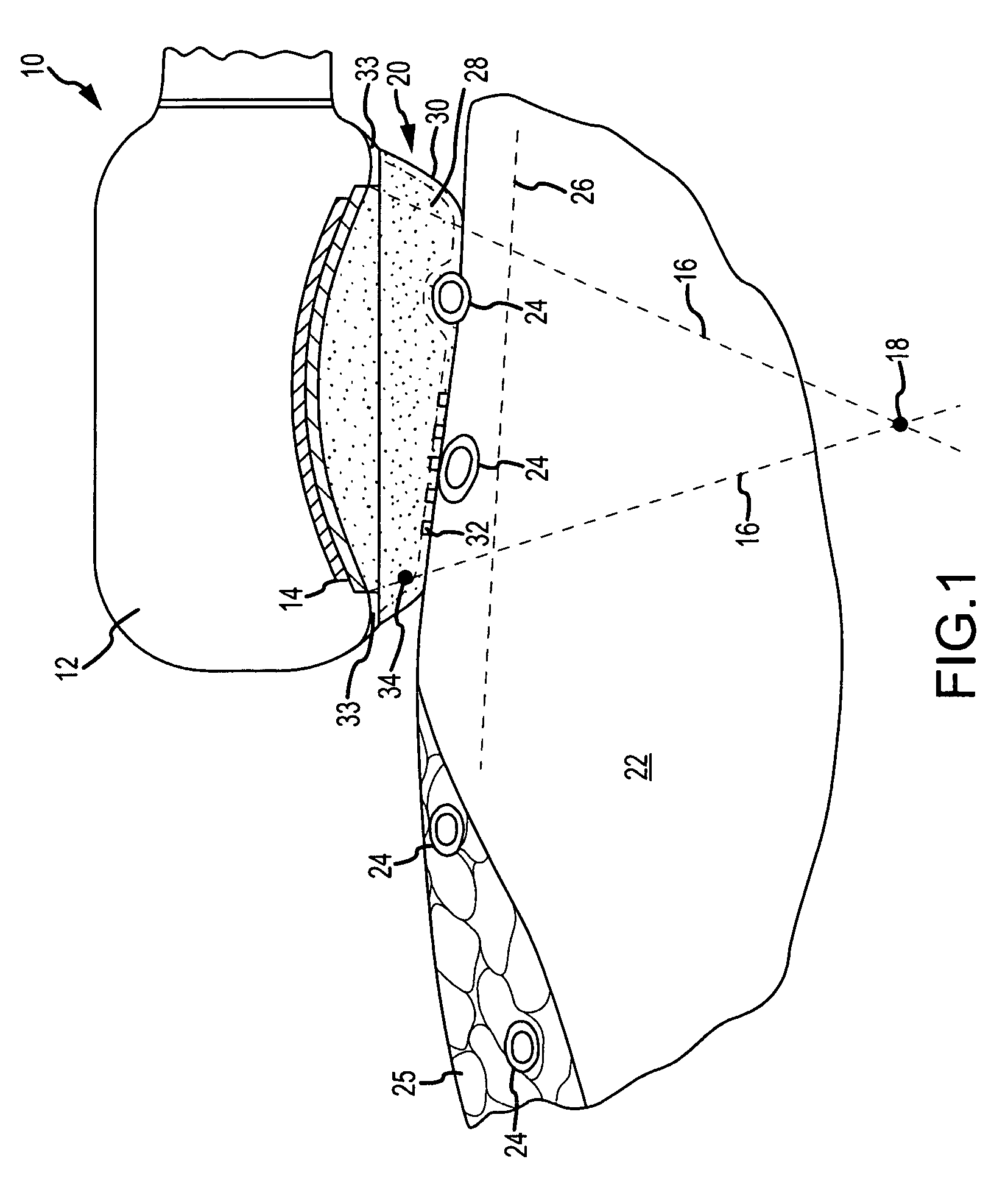 Apparatus and method for tissue ablation with near-field cooling