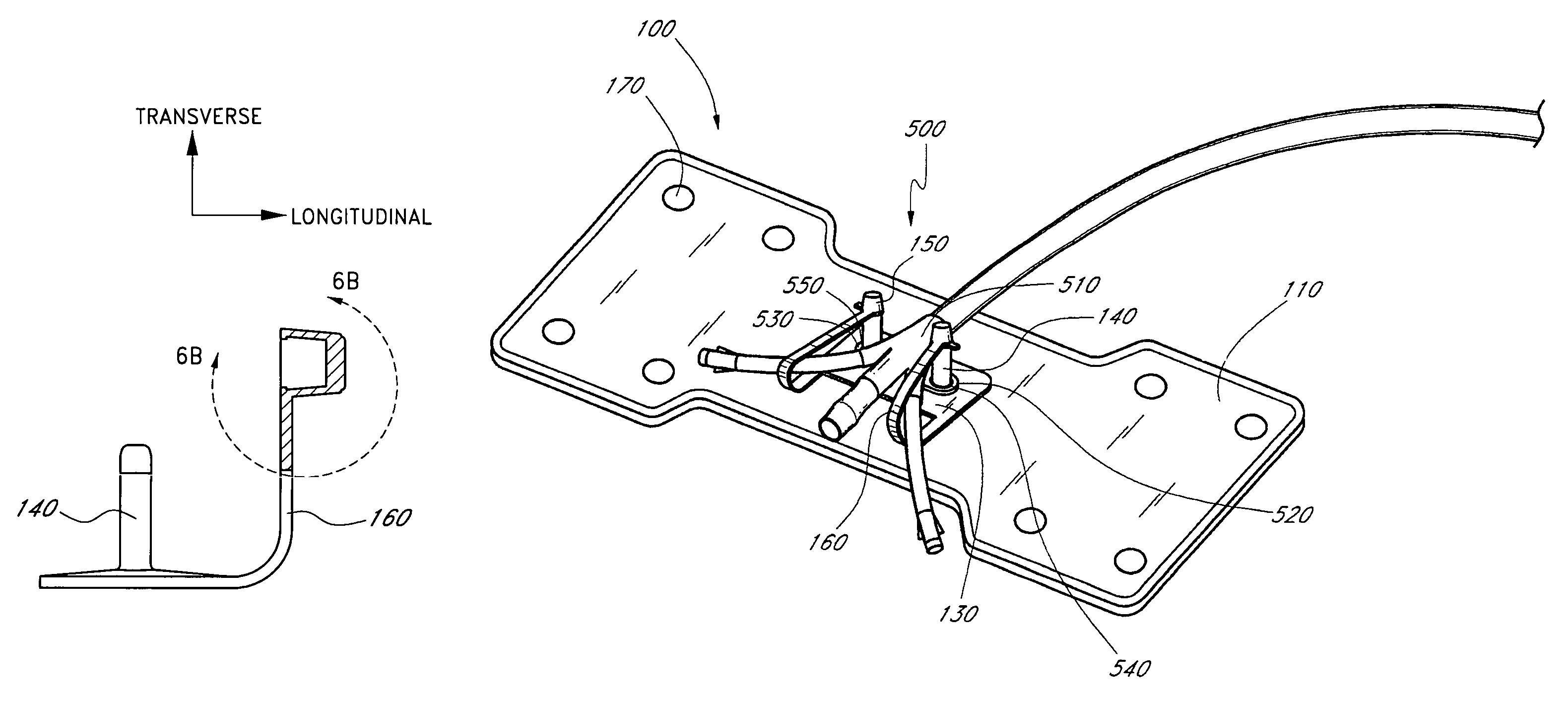 Catheter securement device