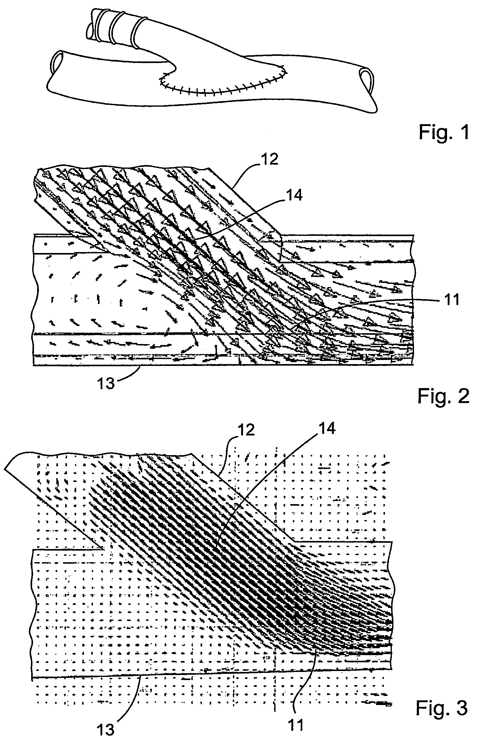 Vascular graft