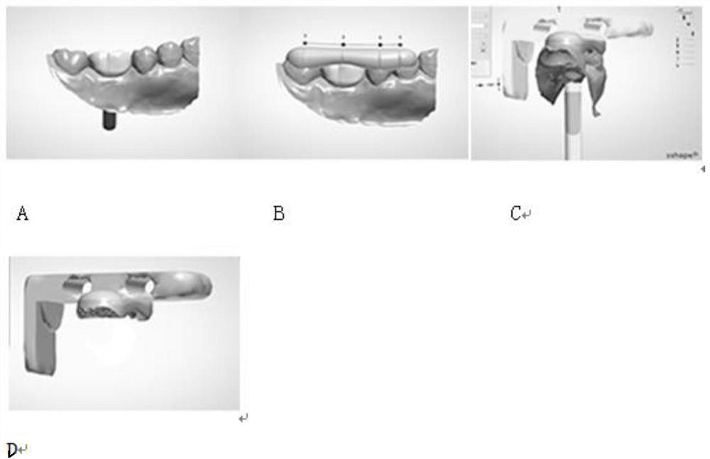 X-ray film holder for implant evaluation and manufacturing method