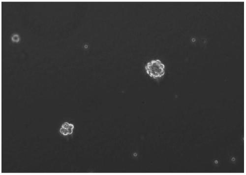 Method for differentiation of amniotic fluid mesenchymal stem cells into neural stem cells