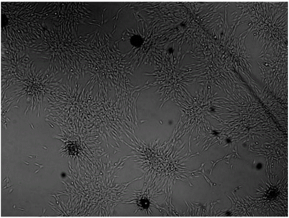 Method for preparing cardiac progenitor cells