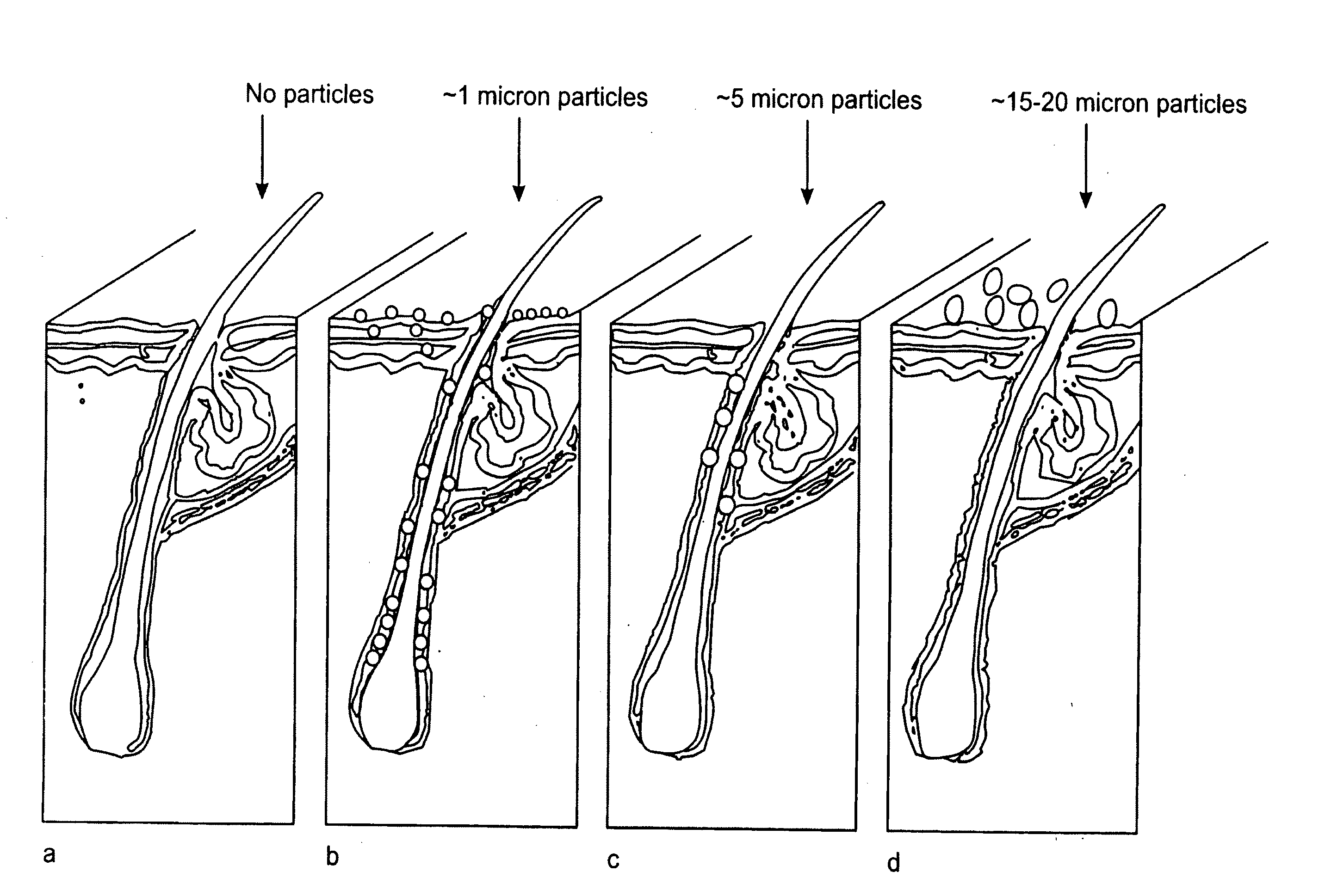 Process for treatment of psoriasis