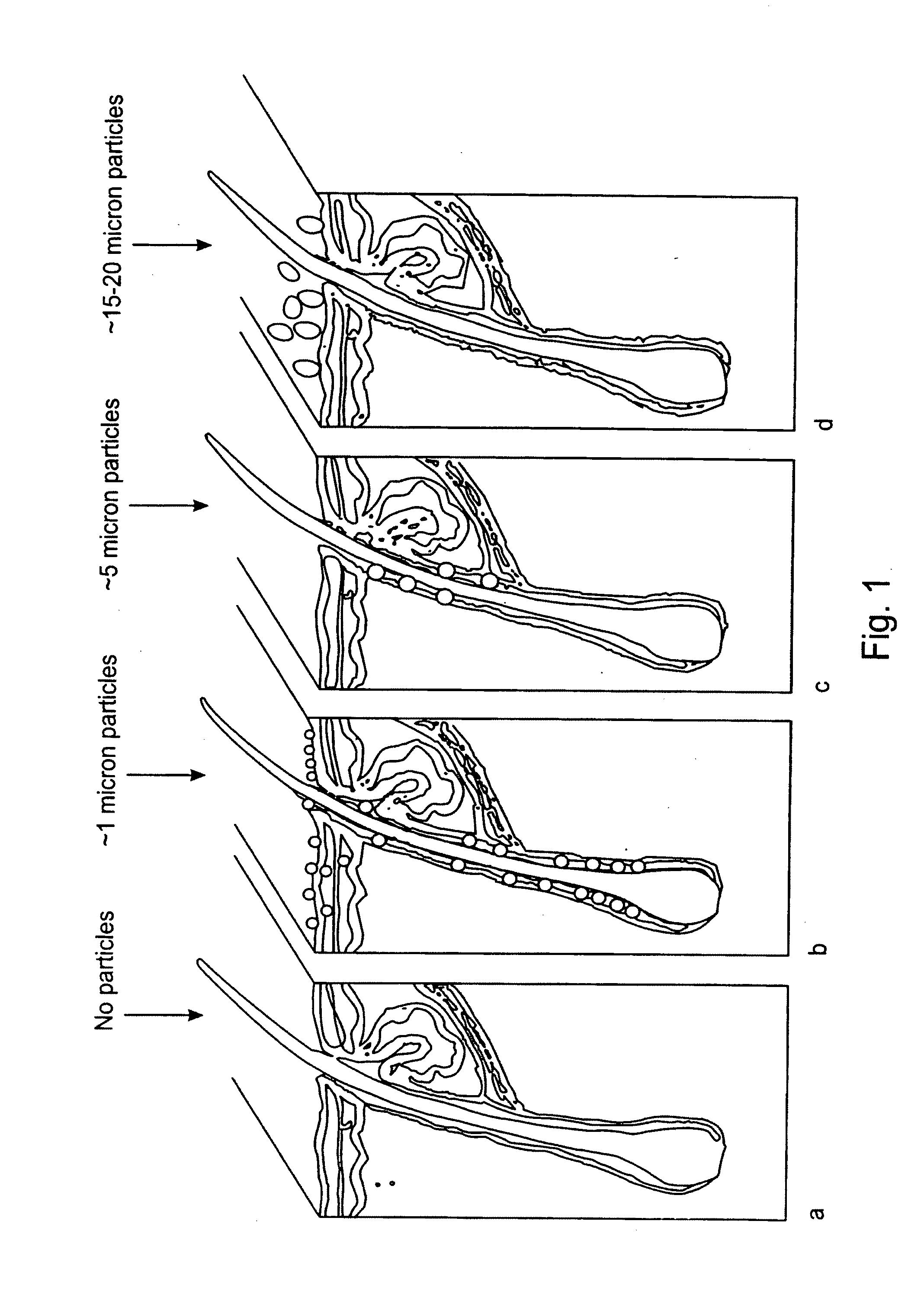 Process for treatment of psoriasis