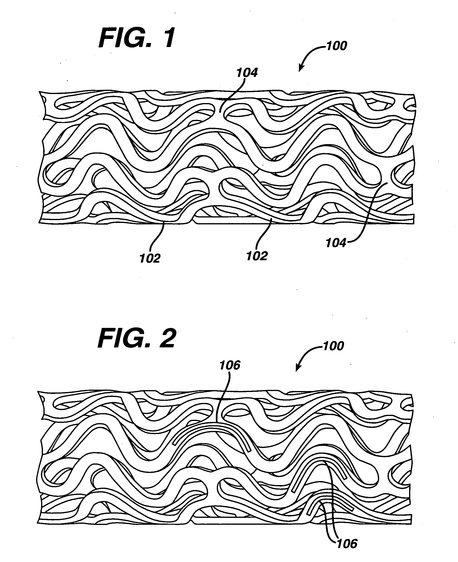 Therapeutic agent elution control process