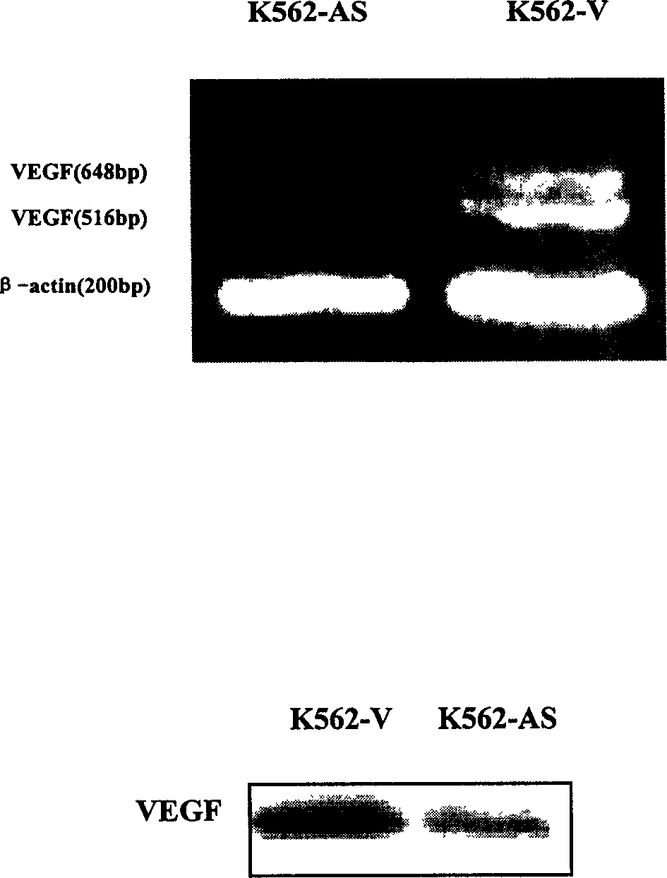 Application of anti-sense VEGF gene sequence