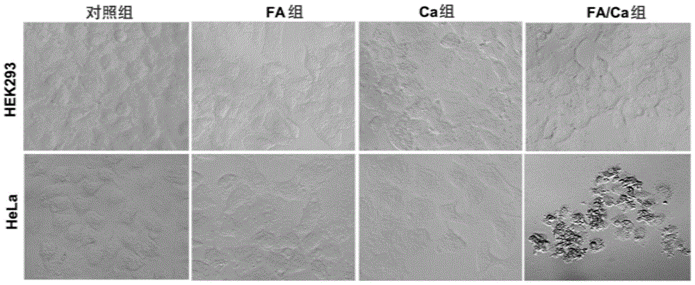 Method for calcification of cancer cells