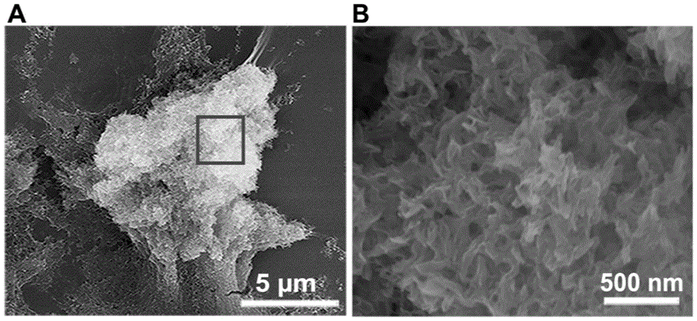 Method for calcification of cancer cells