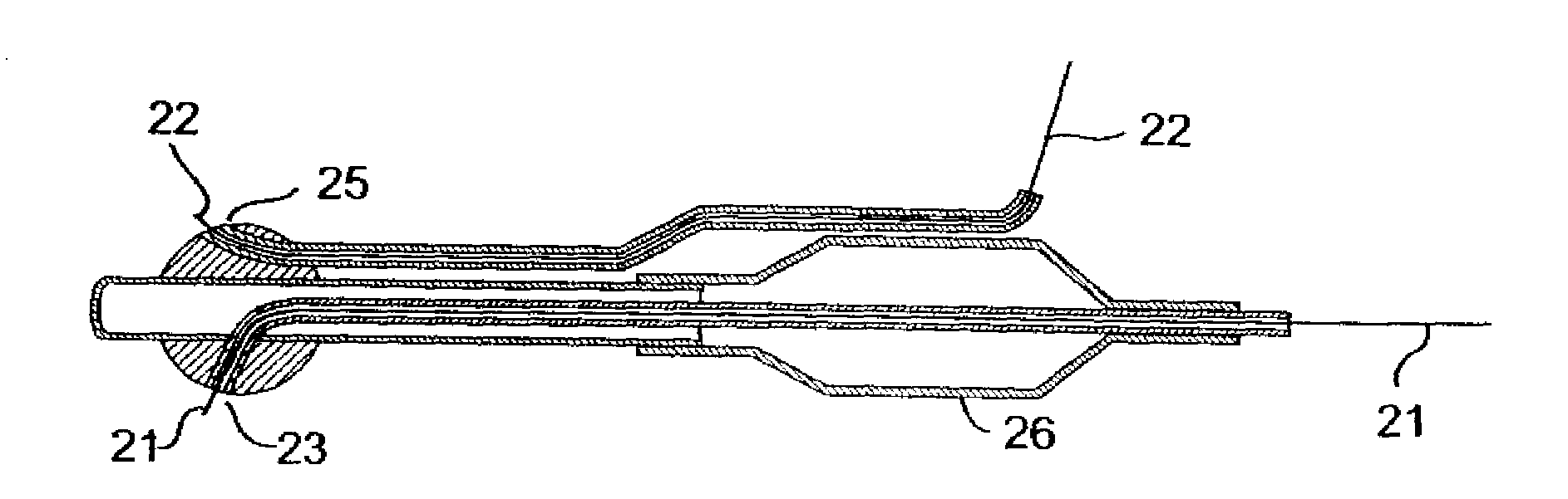 Methods for deploying stents in bifurcations