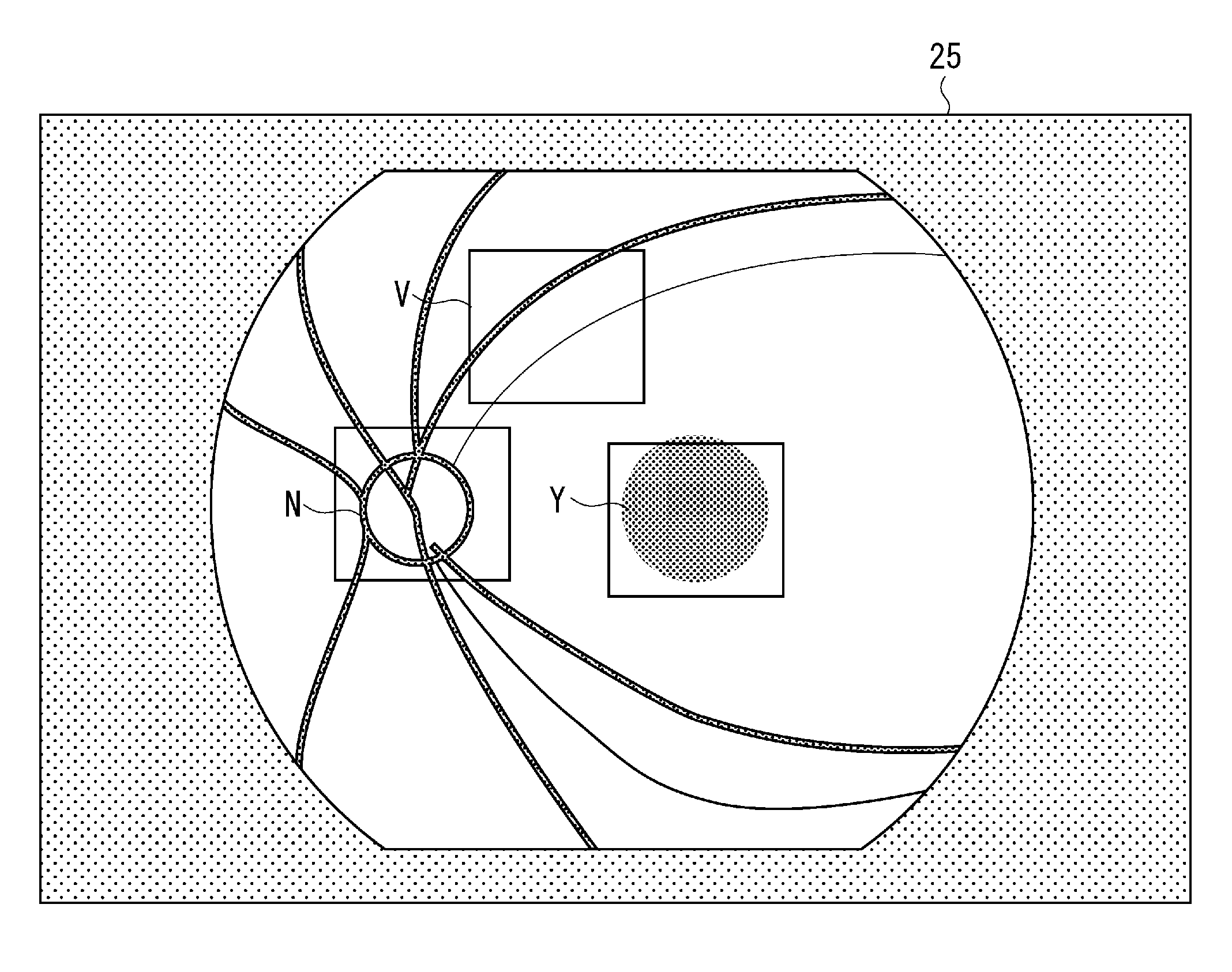 Fundus camera