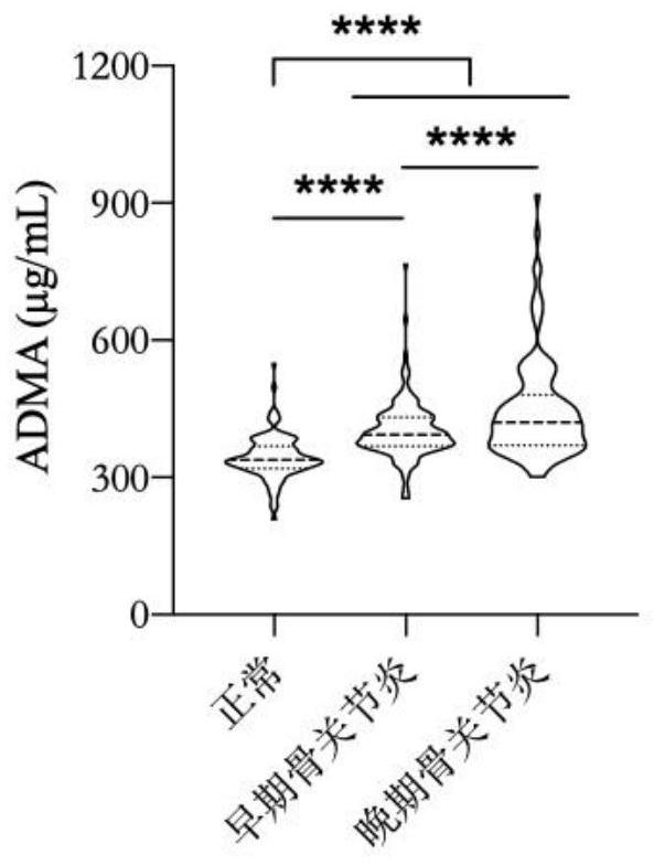 Application of metabolite ADMA in preparation of osteoarthritis diagnostic kit