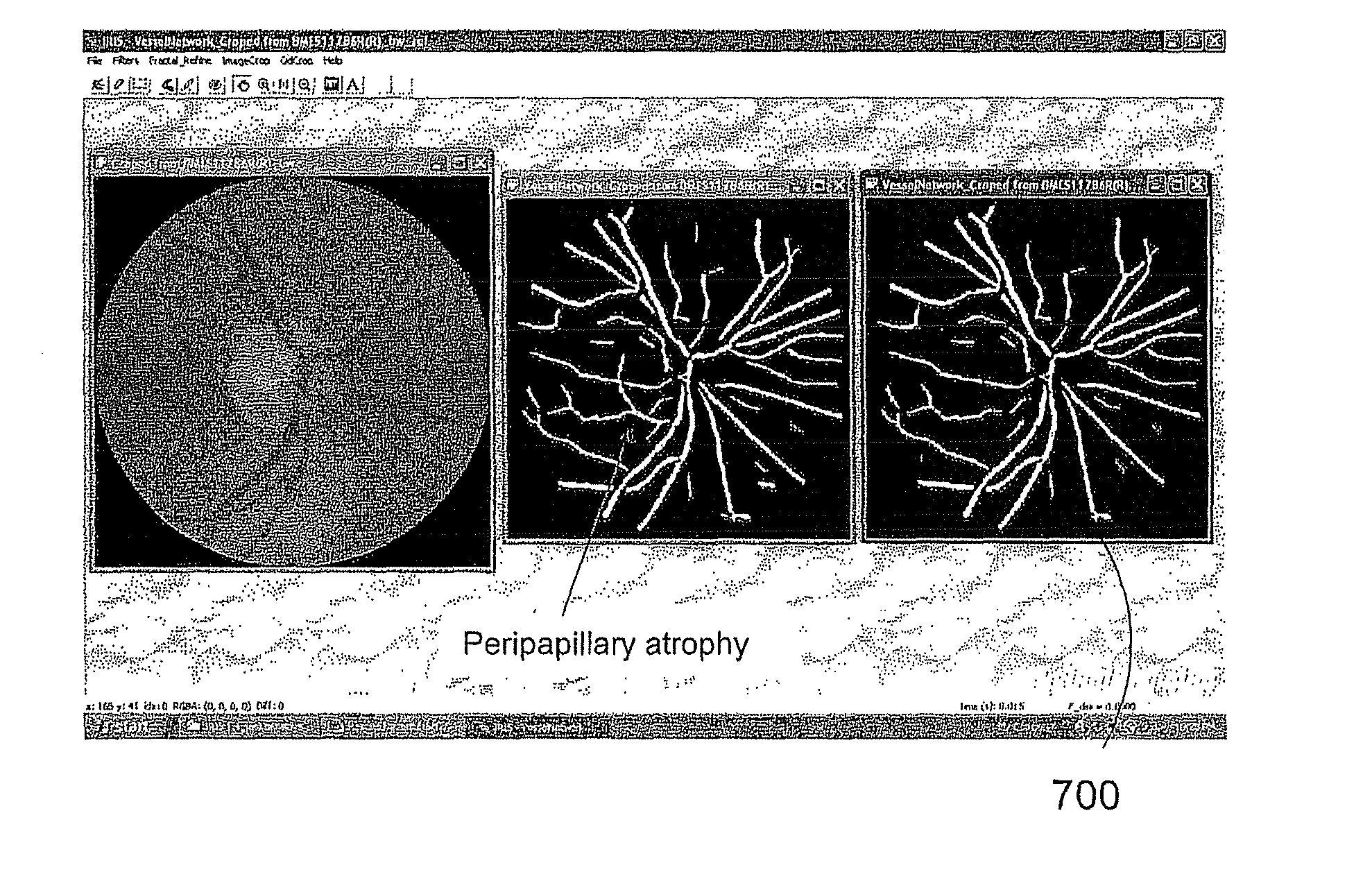 Retinal image analysis systems and methods