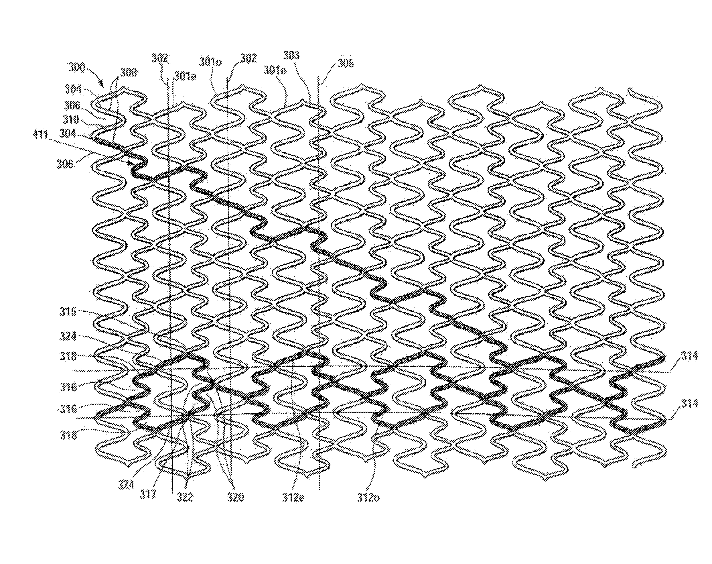 Longitudinally flexible stent