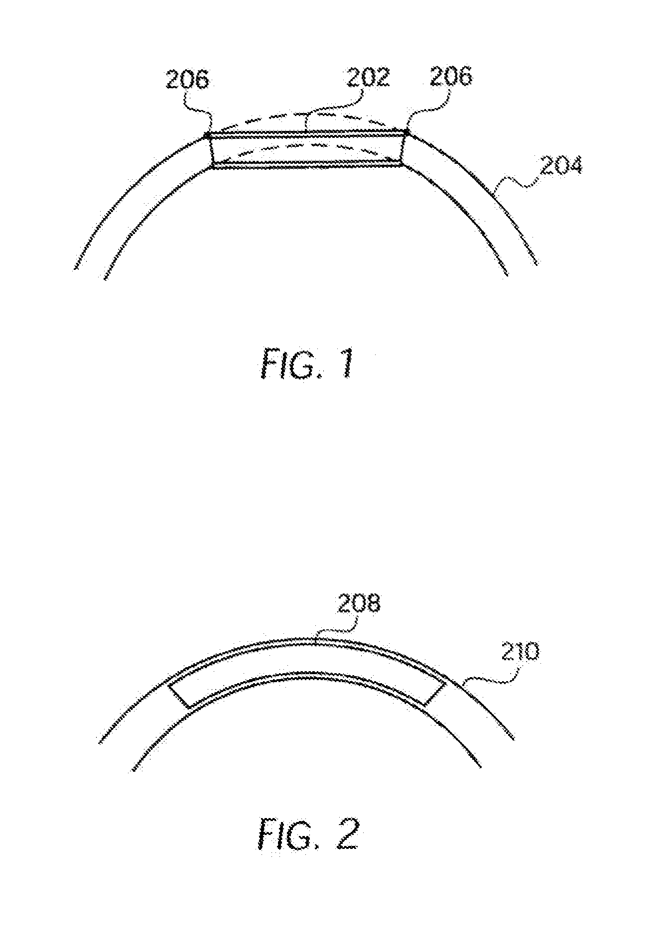 Longitudinally flexible stent